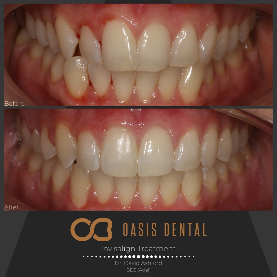 Oasis Dental Studio Palm Beach